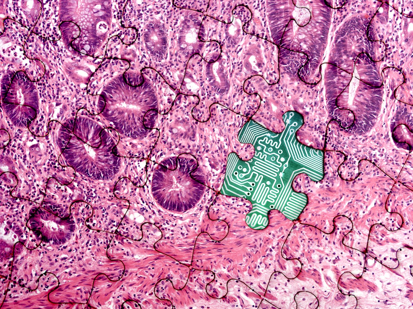 MSc Precision Medicine: Genomics & Analytics
