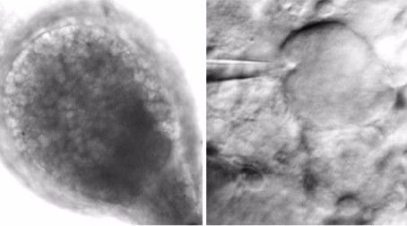 Discovery of ‘mini-brains’ could change understanding of pain medication