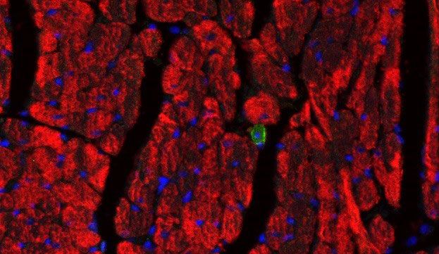 University of Leeds project to develop new treatments for heart failure awarded Heart Research UK grant