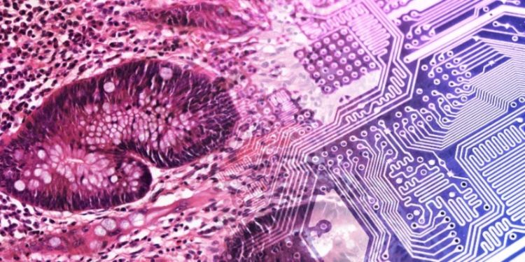 University of Leeds awarded scholarships for underrepresented students in Precision Medicine: Genomic Data Science