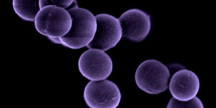'Wolves in sheep's clothing' – the superbugs outsmarting lab tests