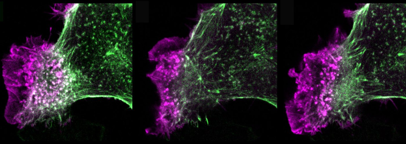 Ruffling cell image by Michelle Peckham