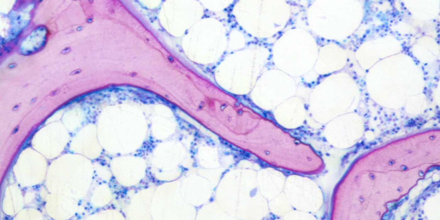 Decellularised bone