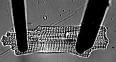 A single cardiac myocyte