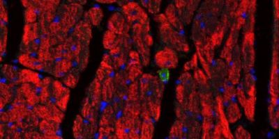 Cardiac remodelling and repair