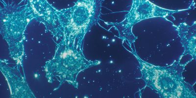 Cells of human connective tissue