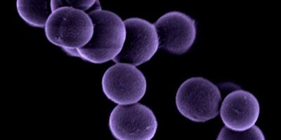 Scientists have found that disease-causing bacteria carry antibiotic resistance genes that are dormant as a result of a genetic mutation. During screening, the bacteria appear susceptible to antibiotics.