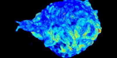 The image shows the membrane of a white blood cell and was produced using super-resolution microscopy.