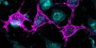 Extracellular matrix of the brain