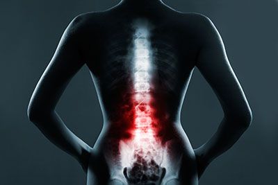 Neural trauma theme
