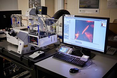 Zeiss lsm880 airyscan