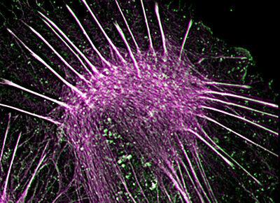 Membranes organelles and cytoskeleton