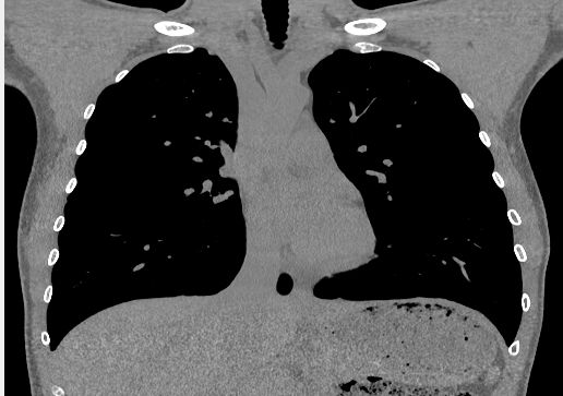 Ageing and the cardiopulmonary system