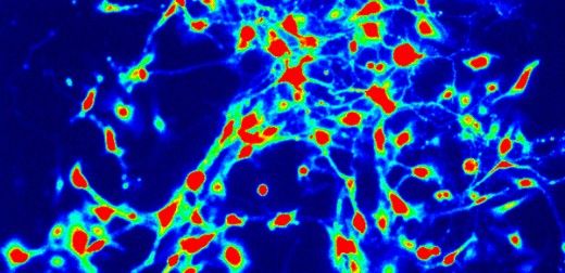 "Pain paradox" discovery provides route to new drugs