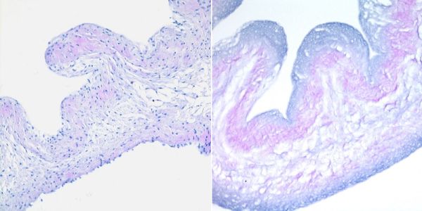 Fresh and decellularised porcine pulmonary valve cusp.
