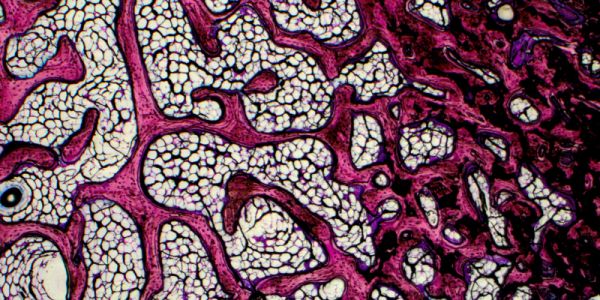 Muscloskeletal TE bone section