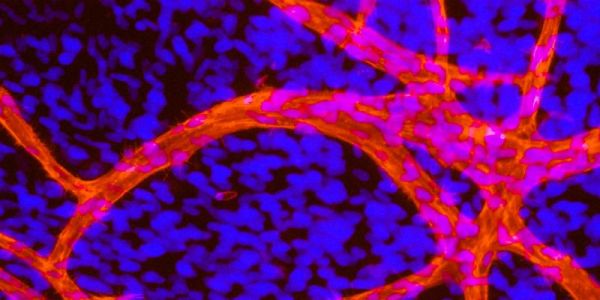 Tumour biology