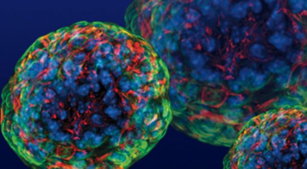 University of Leeds researchers awarded Heart Research UK grant to spot diabetes early