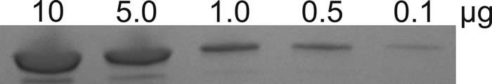 Coomassie-stained gel bands
