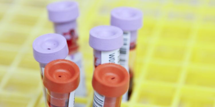 Scientists discover promising new way to personalise treatment for patients with cancer and autoimmune diseases