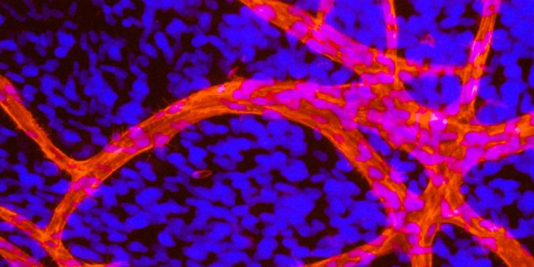 Endothelial tubules