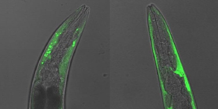 Scientists identify new target for Parkinson’s therapies